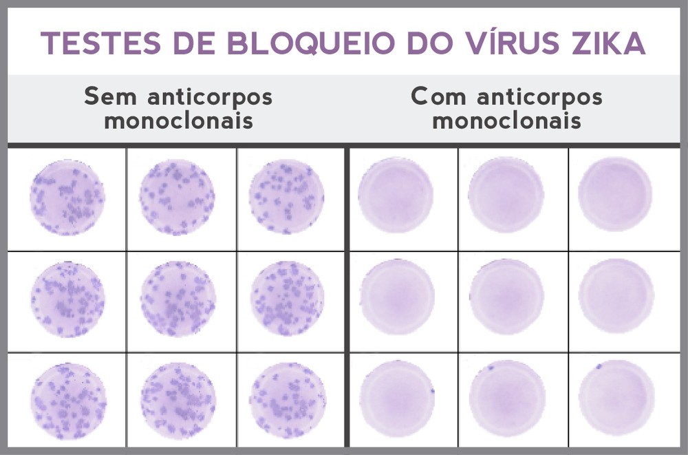 Injeção de anticorpos é proposta de tratamento preventivo contra zika em gestantes